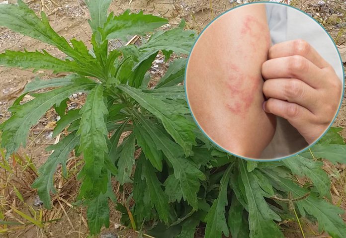 dung-cay-ngai-dai-chua-viem-da-co-dia